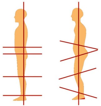 zero-drop-vs-heeled-shoe-posture-diagram